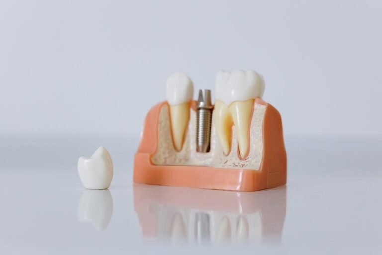 Do dental implants hurt? Sedation Dental Spa Miramar FL
